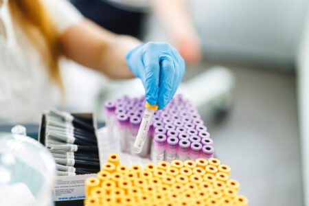 Laboratorijske preiskave