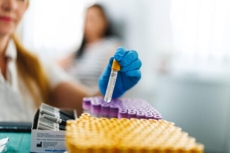 Razširjeni obdobni pregledi (preventivni pregledi)